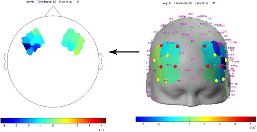 Las neurociencias de la comunicación en salud: un análisis fNIRS de la corteza prefrontal y el consumo de pornografía en mujeres jóvenes para el desarrollo de programas de prevención de la salud
